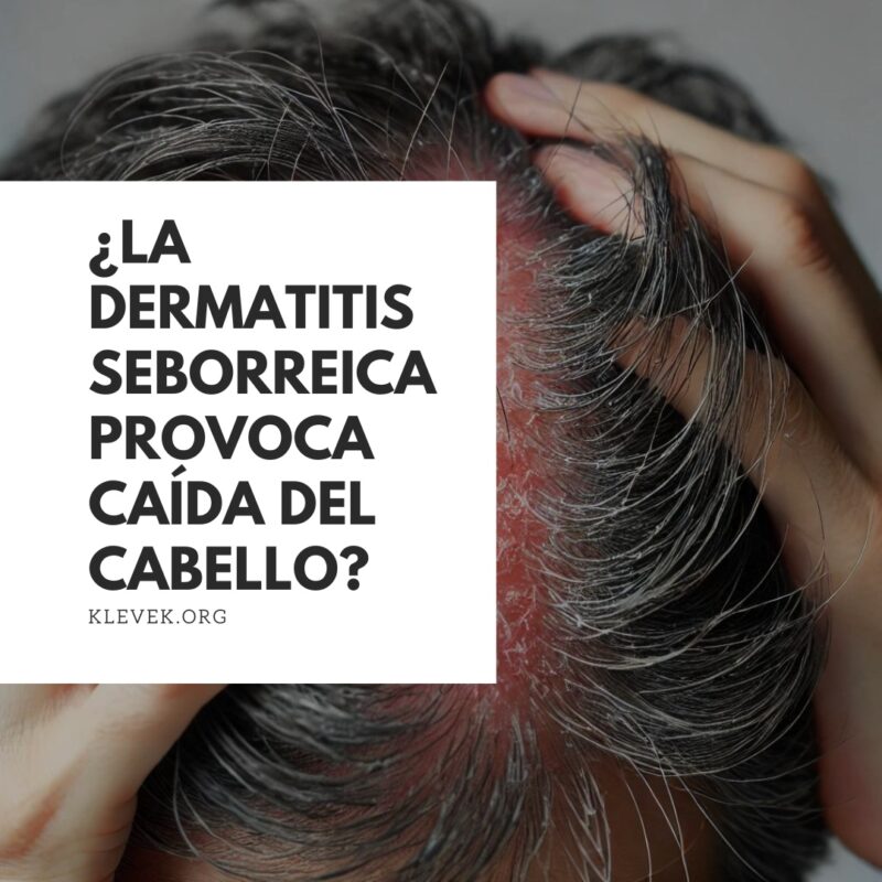 Dermatitis seborreica caída del cabello